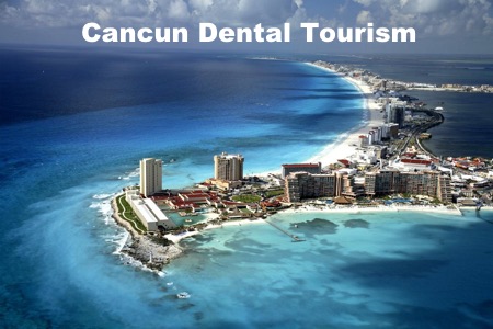 dental tourism cancun